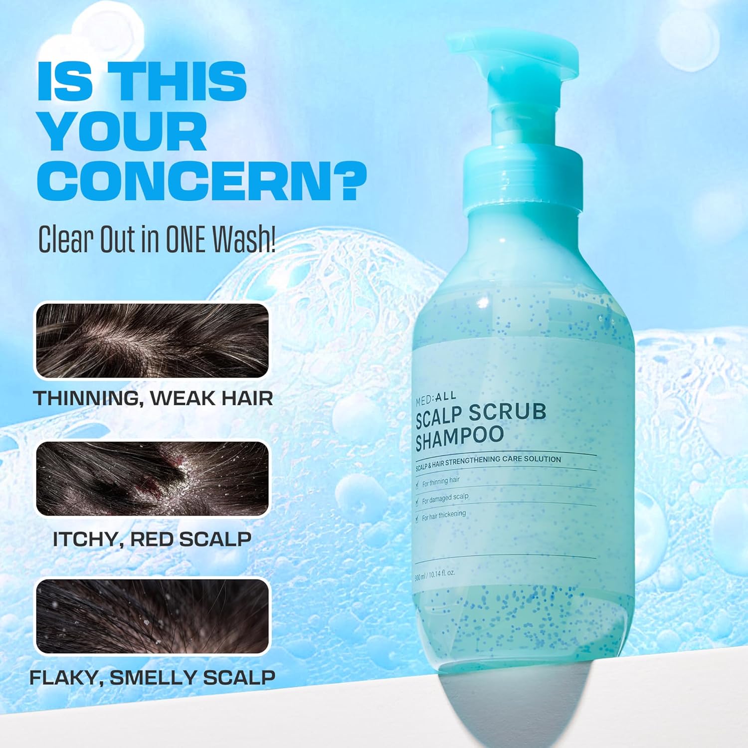 "MEDIALL Purifying Scalp Scrub Shampoo - 10.14 fl.oz - Dandruff Mint for Men & Women, Dry & Itchy Scalp Relief, Exfoliator, Deep Cleansing "